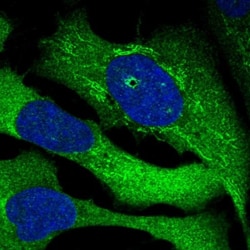 SRBD1 Antibody, Novus Biologicals:Antibodies:Primary Antibodies